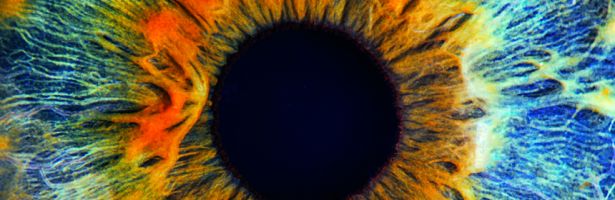 Medizinische Kontaktlinsen für besonders anspruchsvolle Fälle