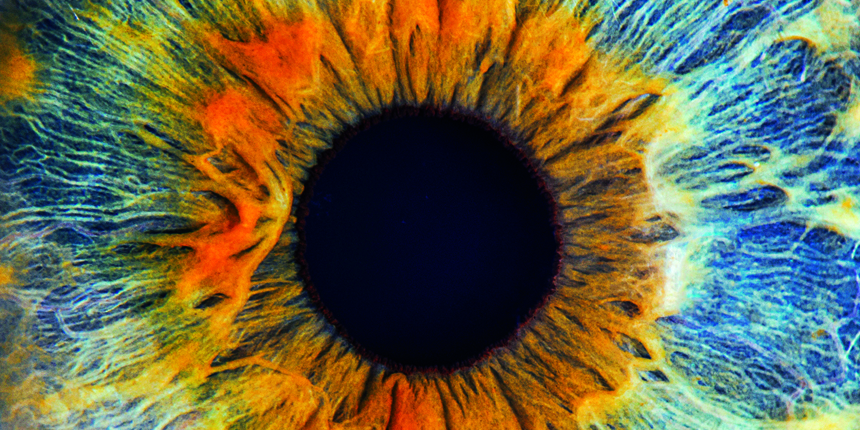 Medizinische Kontaktlinsen für besonders anspruchsvolle Fälle